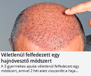 e1e8ef18