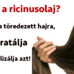 a-haj-vastagitasahoz-es-novesztesehez-a-legjobb-a-ricinusolaj