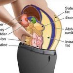 a-zsirsejtekben-levo-mereganyagok-hizlalnak-es-puffasztanak-igy-tisztitsd-meg-a-szervezeted