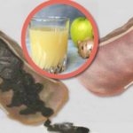 nezd-hogyan-tisztithatod-meg-vastagbeledet-es-szabadulhatsz-meg-plusz-kiloktol-ezzel-keverekkel2